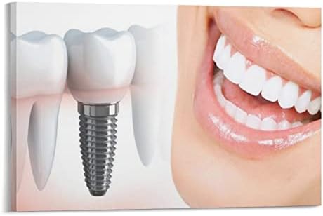 A arte dos implantes dentários ， Serviços odontológicos, Clínica Odontológica, Arte da parede de escritório