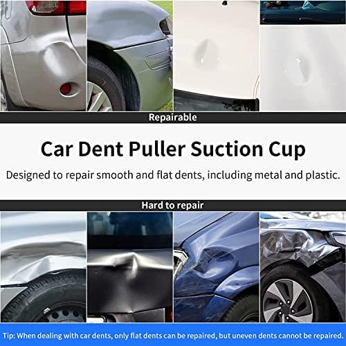 Moukim Car Dent Pulcer Cup Cup Cunte Dent Remoção Copo de otim