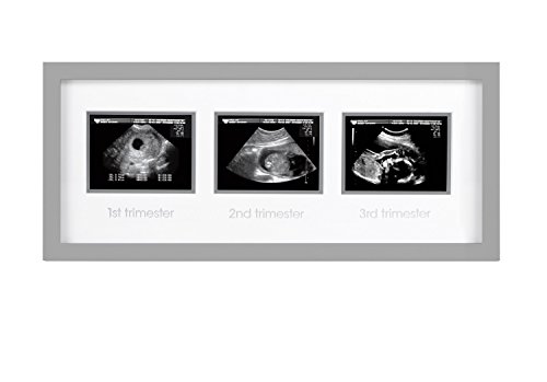 Moldura de imagem do sonograma triplo de Pearhead, gravidez com moldura fotográfica, decoração de berçário